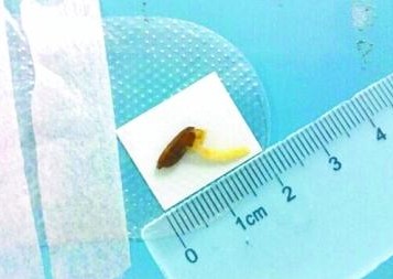 网曝某天后吸毒被抓警方未证实多名女星躺枪