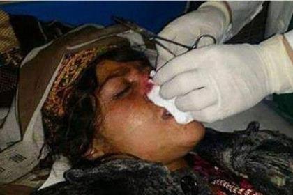  男子将老婆割鼻 (组图):小三上位,正室落败惨遭