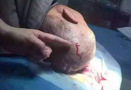 福建 女警 持 高跟鞋敲 破 保安 头▏绥安  女警 高跟 