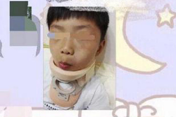 幼儿园老师让男孩打架互殴(图)竟是为了发泄精