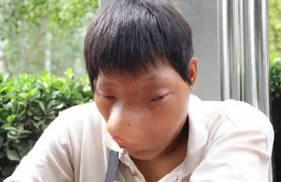 河南<em>大学</em>生患怪病 面部畸形靠做人肉沙包筹钱